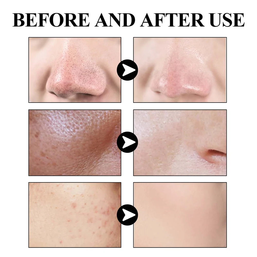 West & Month Blackhead Remove Solid Mud Film Refreshing Skin Cleaning Face Mask Moisturize Control Oil Shrink Pores Skin Care - LaTezza Online Shop