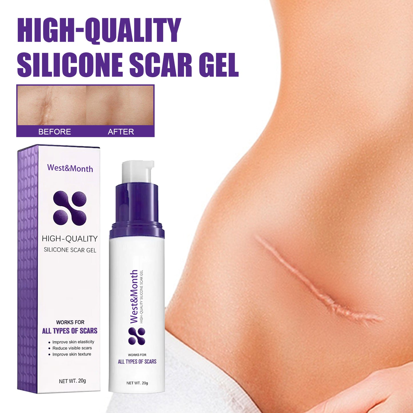 West&Month High-quality Silicone Scar Gel, Lighten Acne Mark Scar Repair Skin Smoothing Care Cream - LaTezza Online Shop