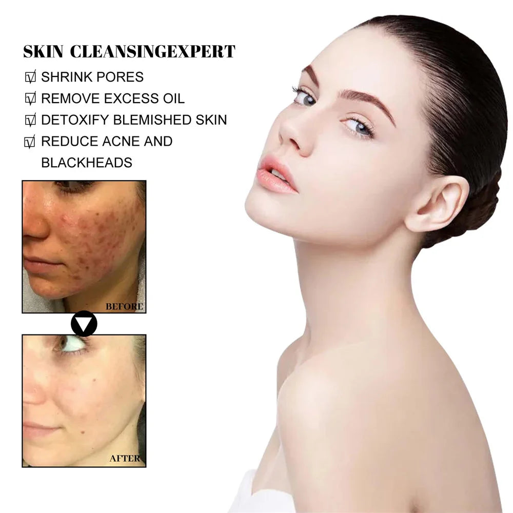 West & Month Blackhead Remove Solid Mud Film Refreshing Skin Cleaning Face Mask Moisturize Control Oil Shrink Pores Skin Care - LaTezza Online Shop
