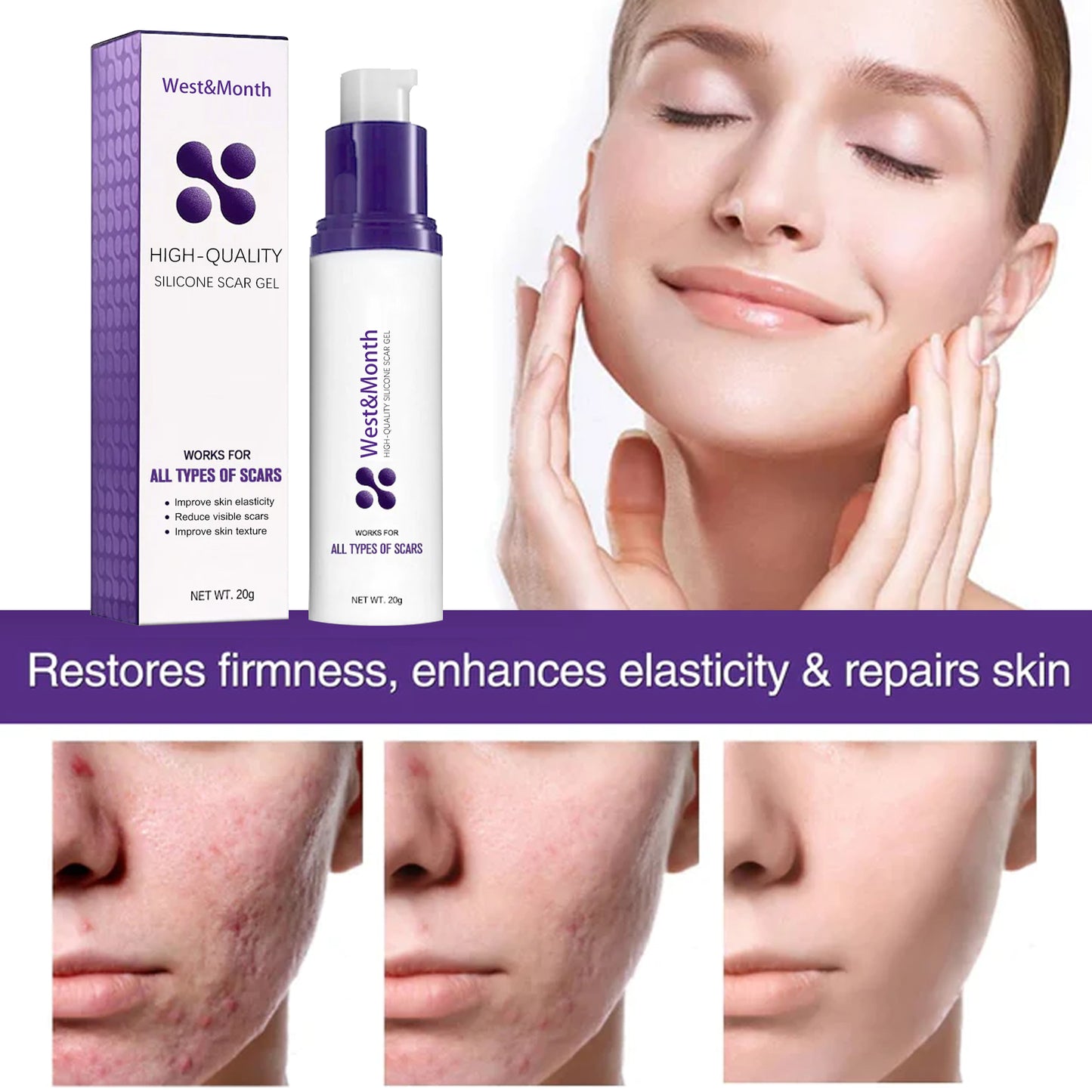 West&Month High-quality Silicone Scar Gel, Lighten Acne Mark Scar Repair Skin Smoothing Care Cream - LaTezza Online Shop