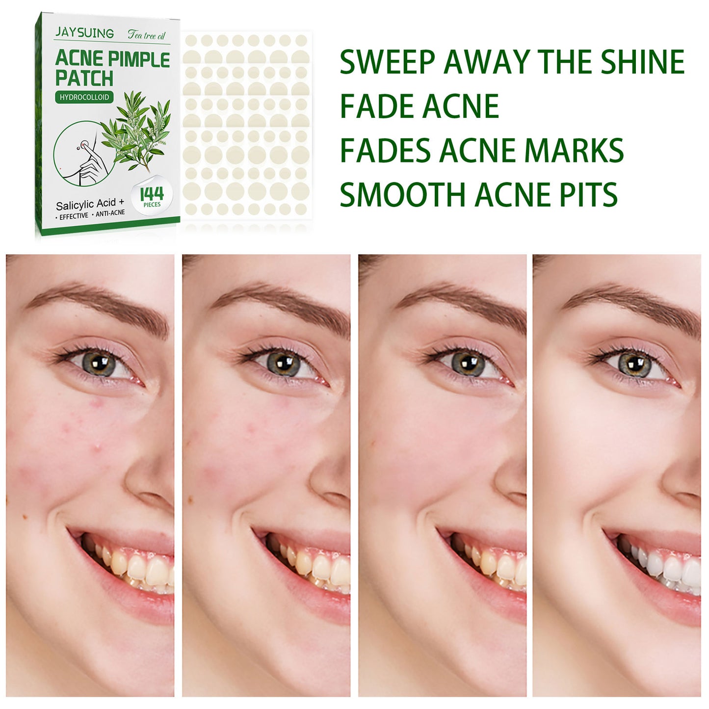 Jaysuing Waterproof Invisible Acne Patch Lighten Acne Acne Print Moisturizing Repair Clear Patch - LaTezza Online Shop