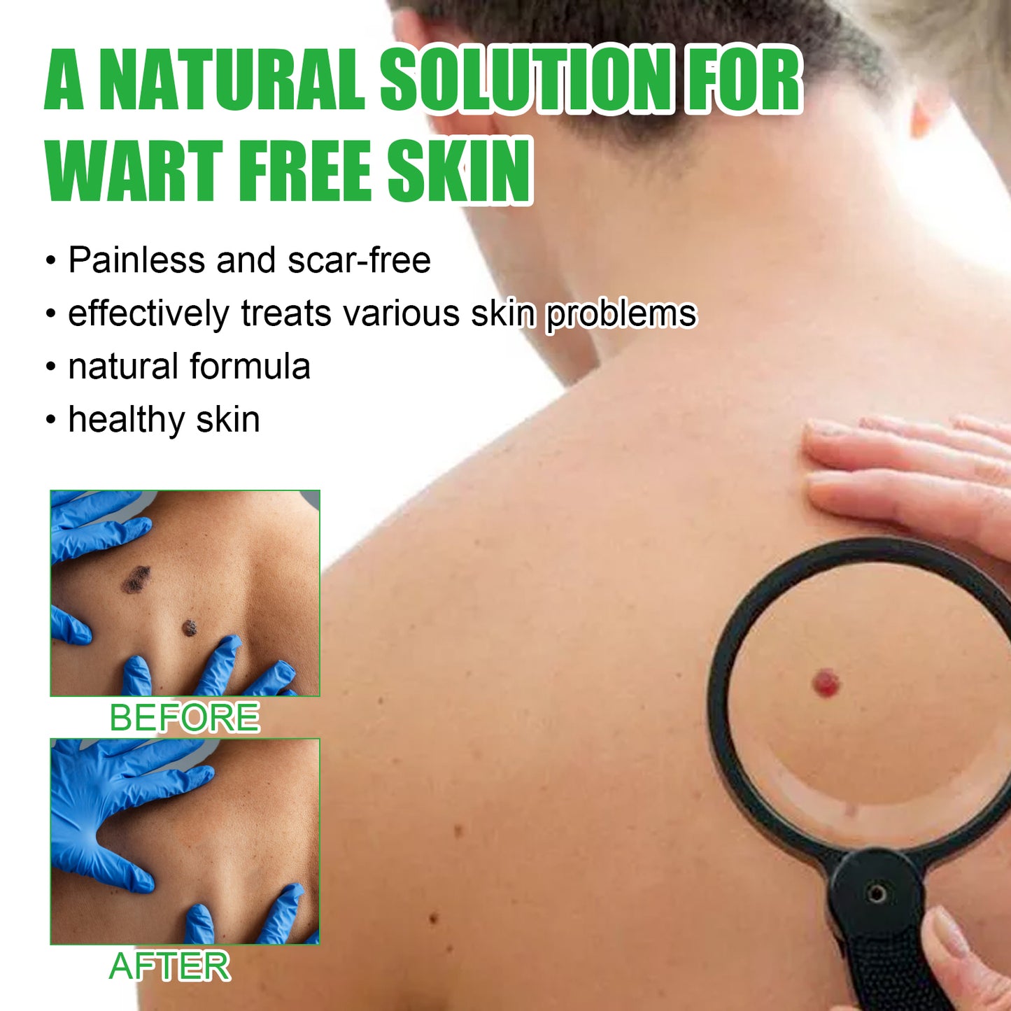 West&Month Mole Remover Soap, Repair Meat Granules Corns And Dark Moles, Smooth Skin Anti-wart Cleansing Soap - LaTezza Online Shop