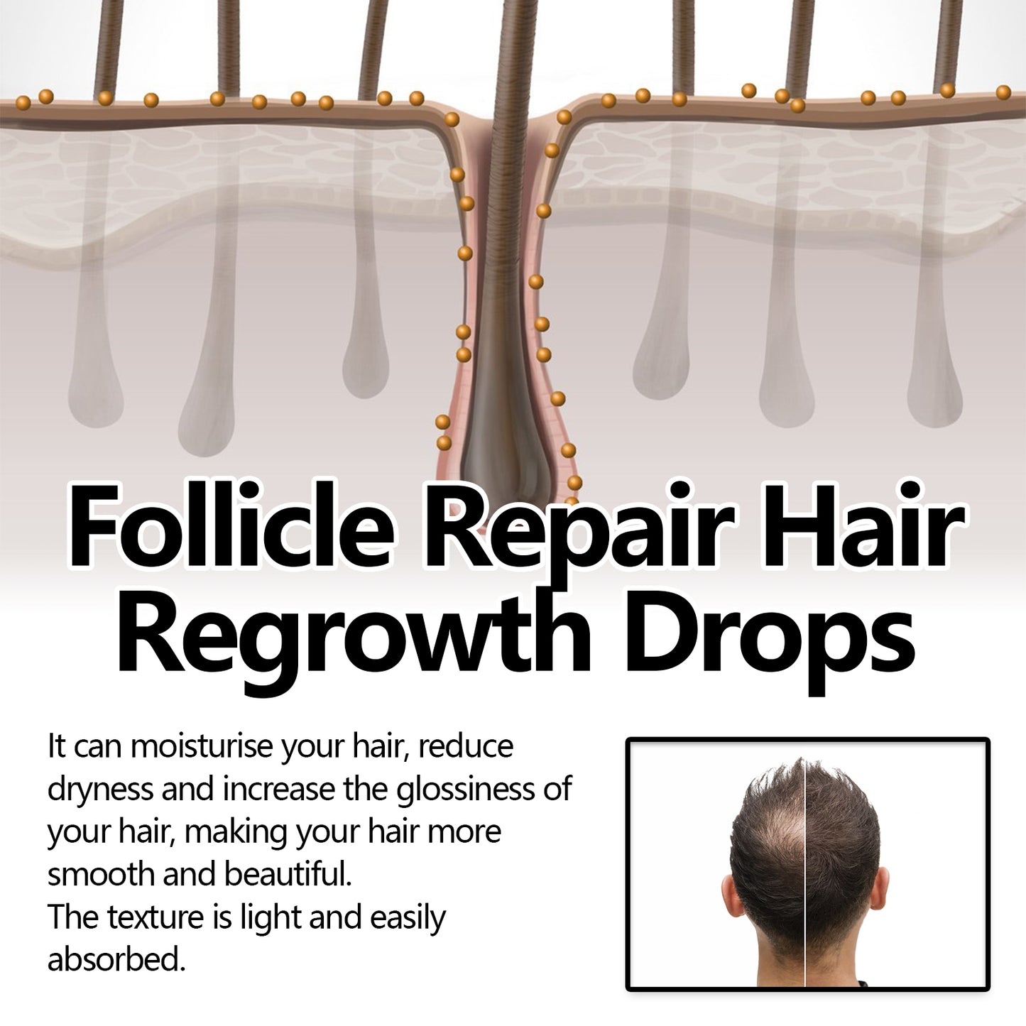 Follicle Repair Hair Regrowth Drops, Hair Protection Strong And Solid Hair Thickening Scalp Nourishing Massage Lotion - LaTezza Online Shop