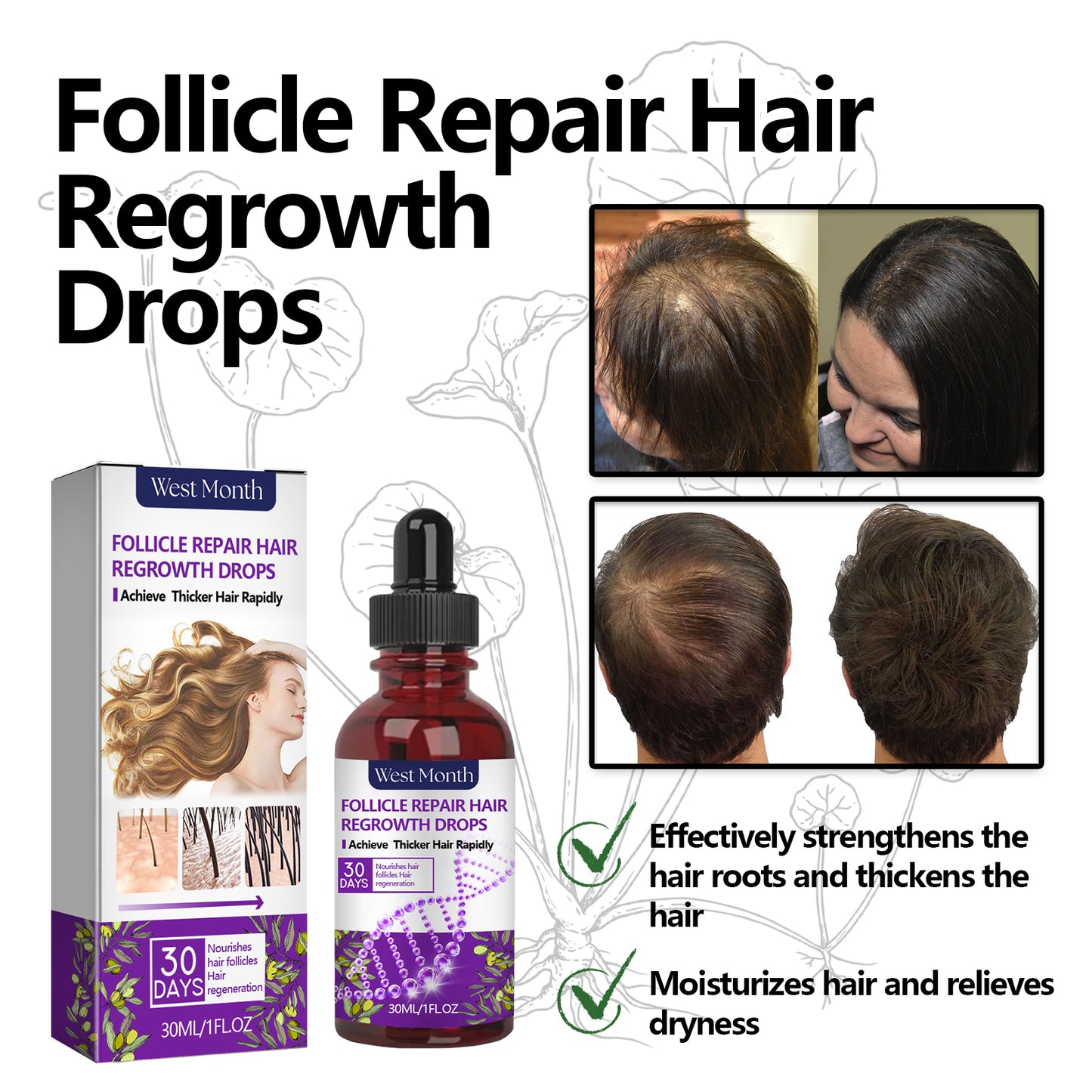 Follicle Repair Hair Regrowth Drops, Hair Protection Strong And Solid Hair Thickening Scalp Nourishing Massage Lotion - LaTezza Online Shop