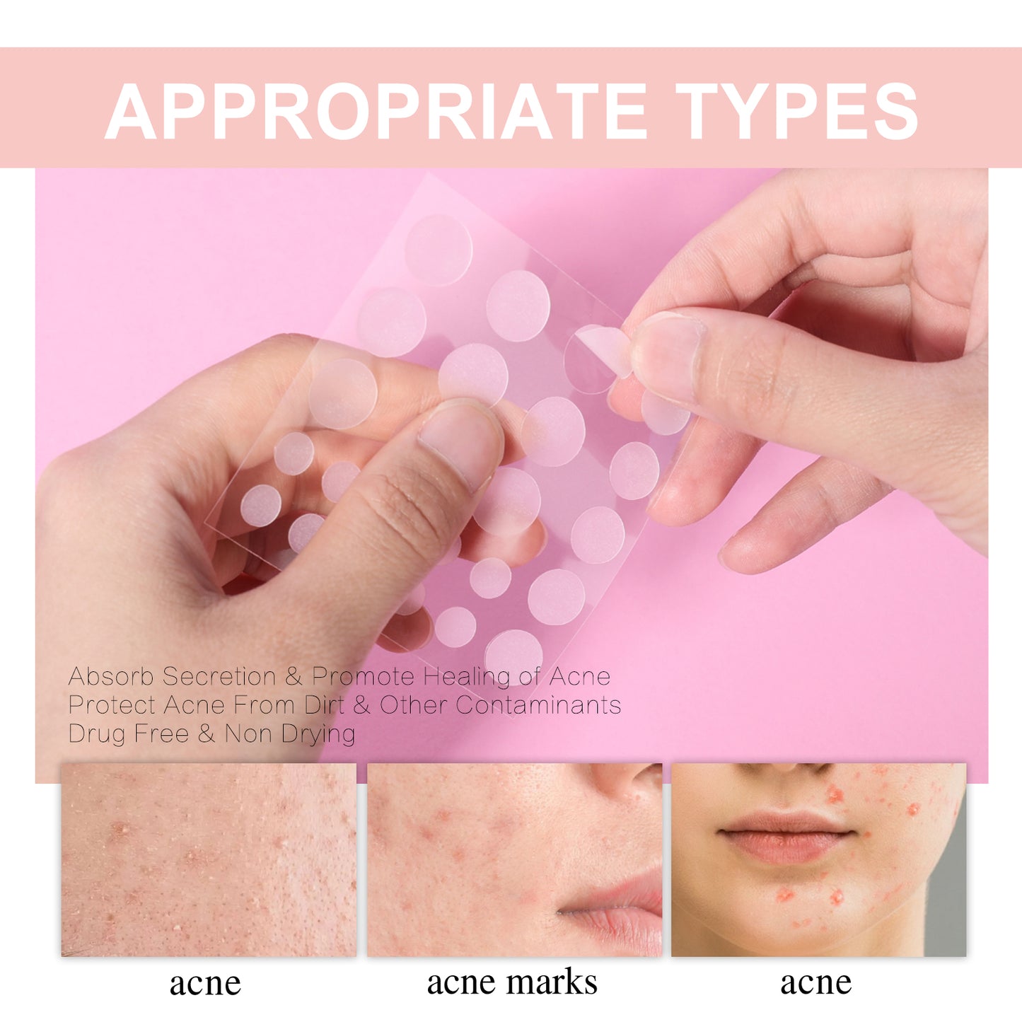 Hydrocolloid Acne Patch, Repair Acne Pimples Acne Invisible Concealer Breathable Acne Patch - LaTezza Online Shop