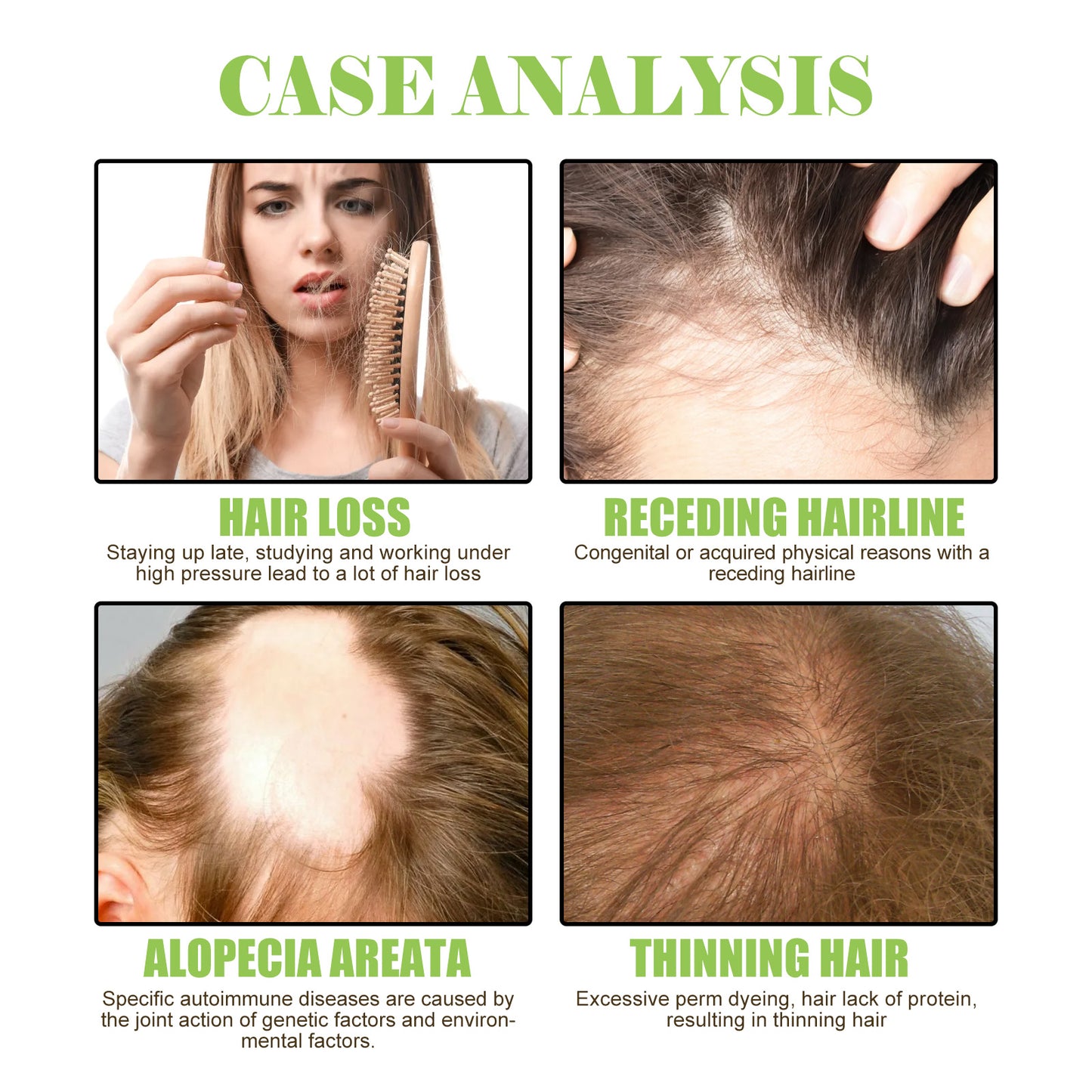 South Moon Ginger Care Shampoo Scalp Cleansing, Anti-Break Nourishing Root Strengthening Shampoo - LaTezza Online Shop