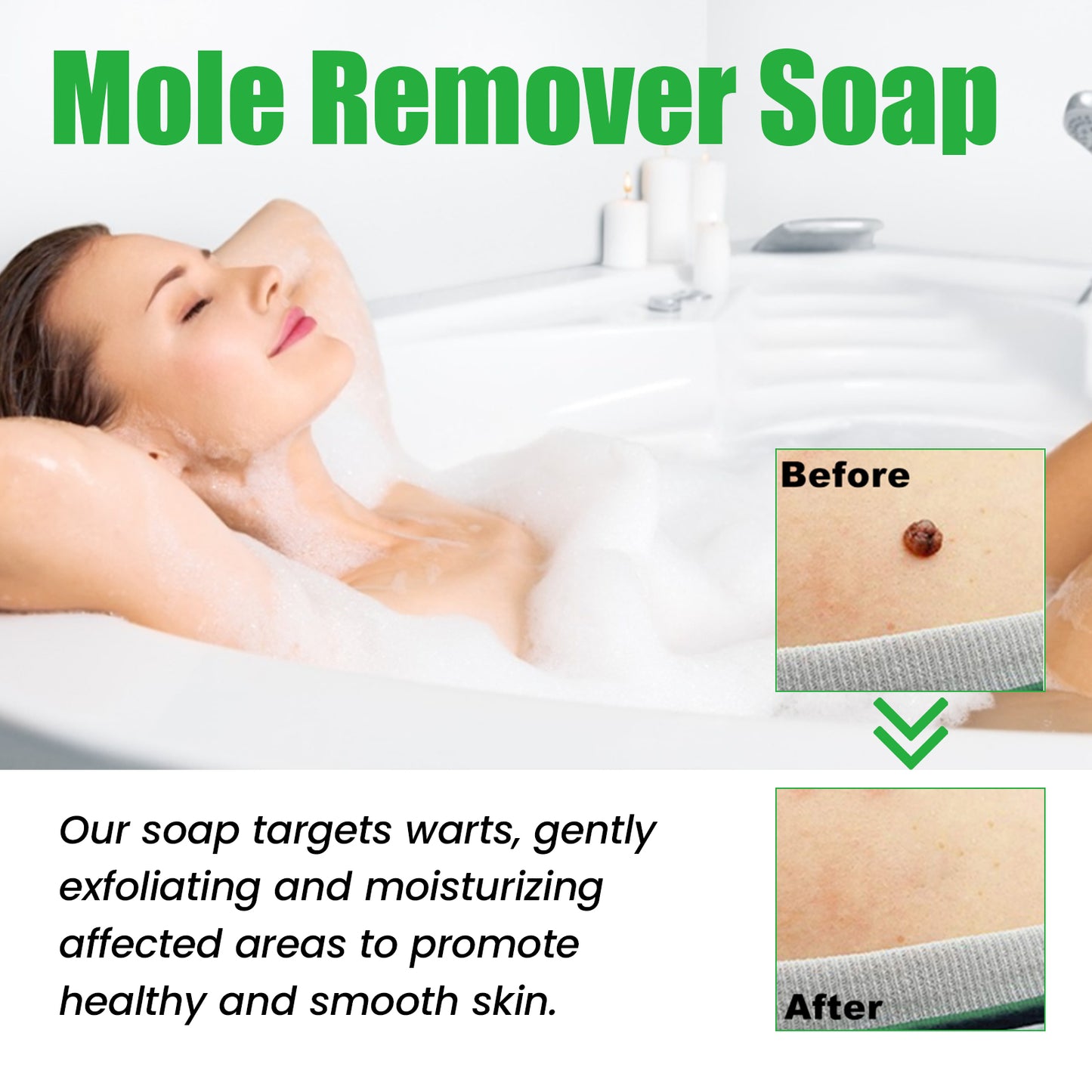 West&Month Mole Remover Soap, Repair Meat Granules Corns And Dark Moles, Smooth Skin Anti-wart Cleansing Soap - LaTezza Online Shop