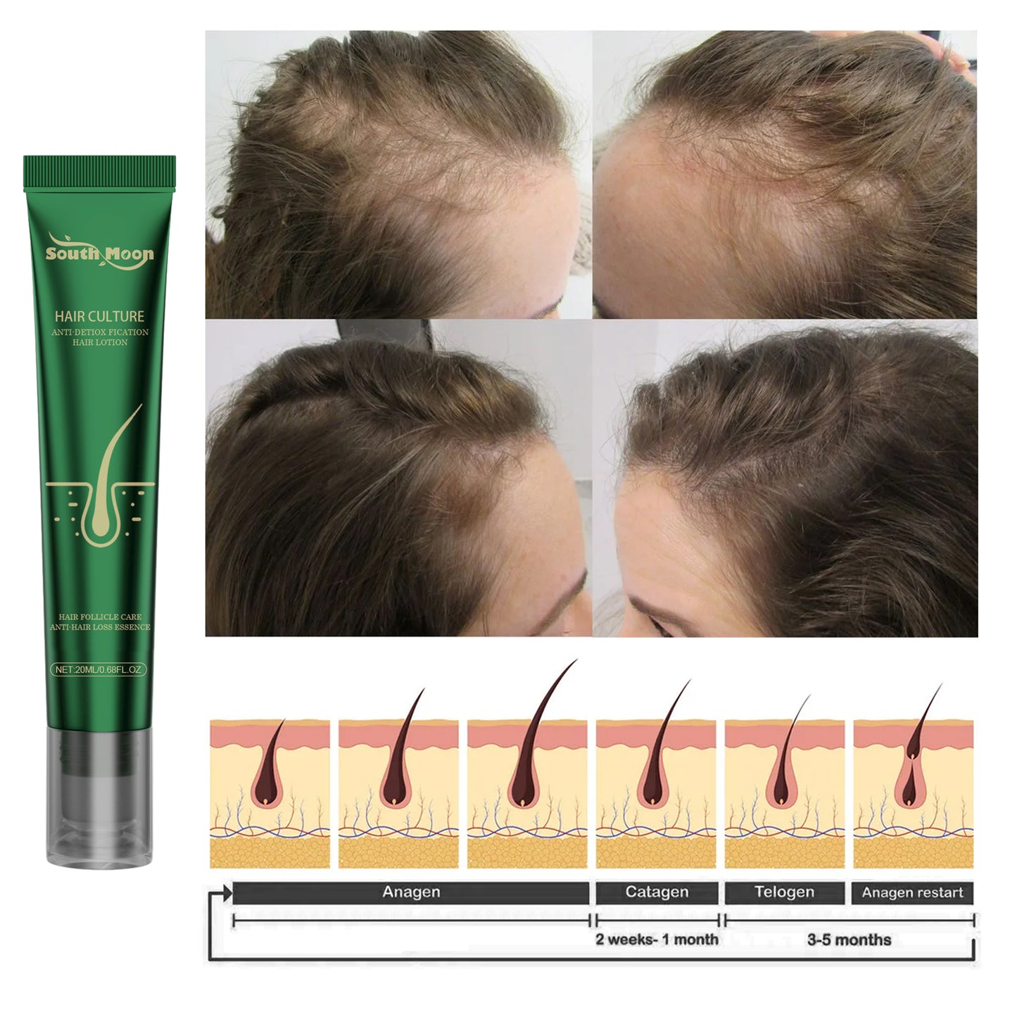 South Moon Scalp Essence Ginger Gently Moisturizes And Moisturizes Dry And Dry Hair - LaTezza Online Shop