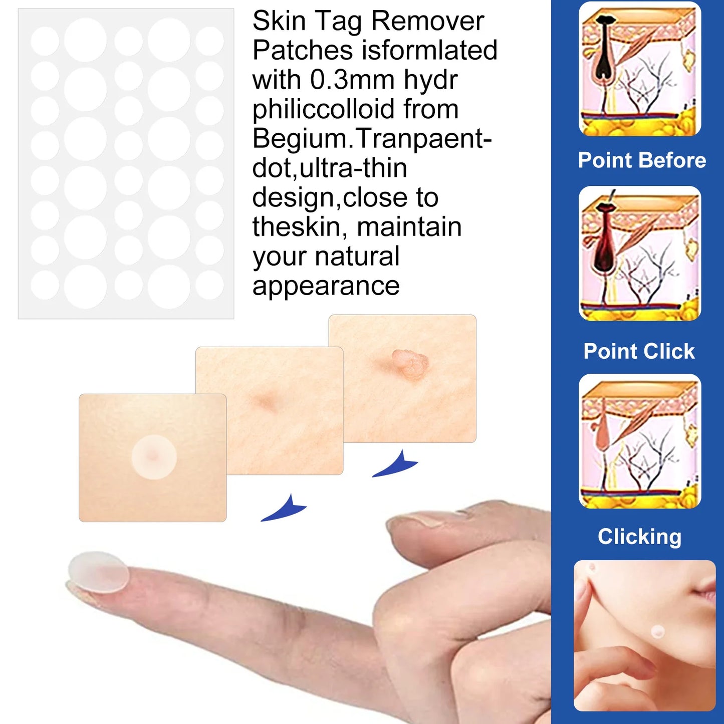 2 In1 Painless Auto Skin Tag Mole Wart Removal Kit Cleaning Tools Face Skin Care Body Wart Dot Treatments Remover Beauty Health