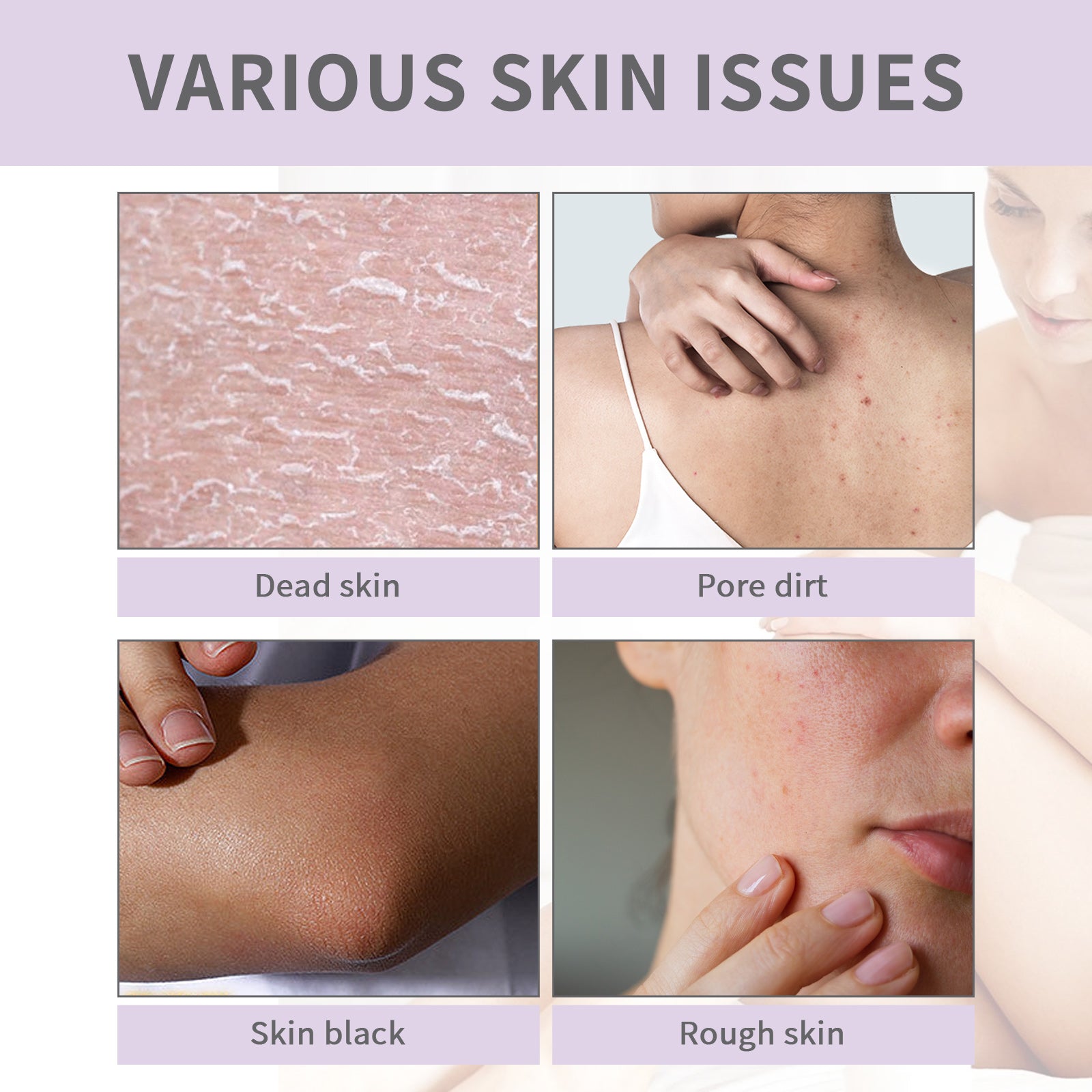 West&Month Body Skin Moisturizing Soap, Clear Acne Print Repair Dark Moisturizing Whitening Body Wash Soap - LaTezza Online Shop