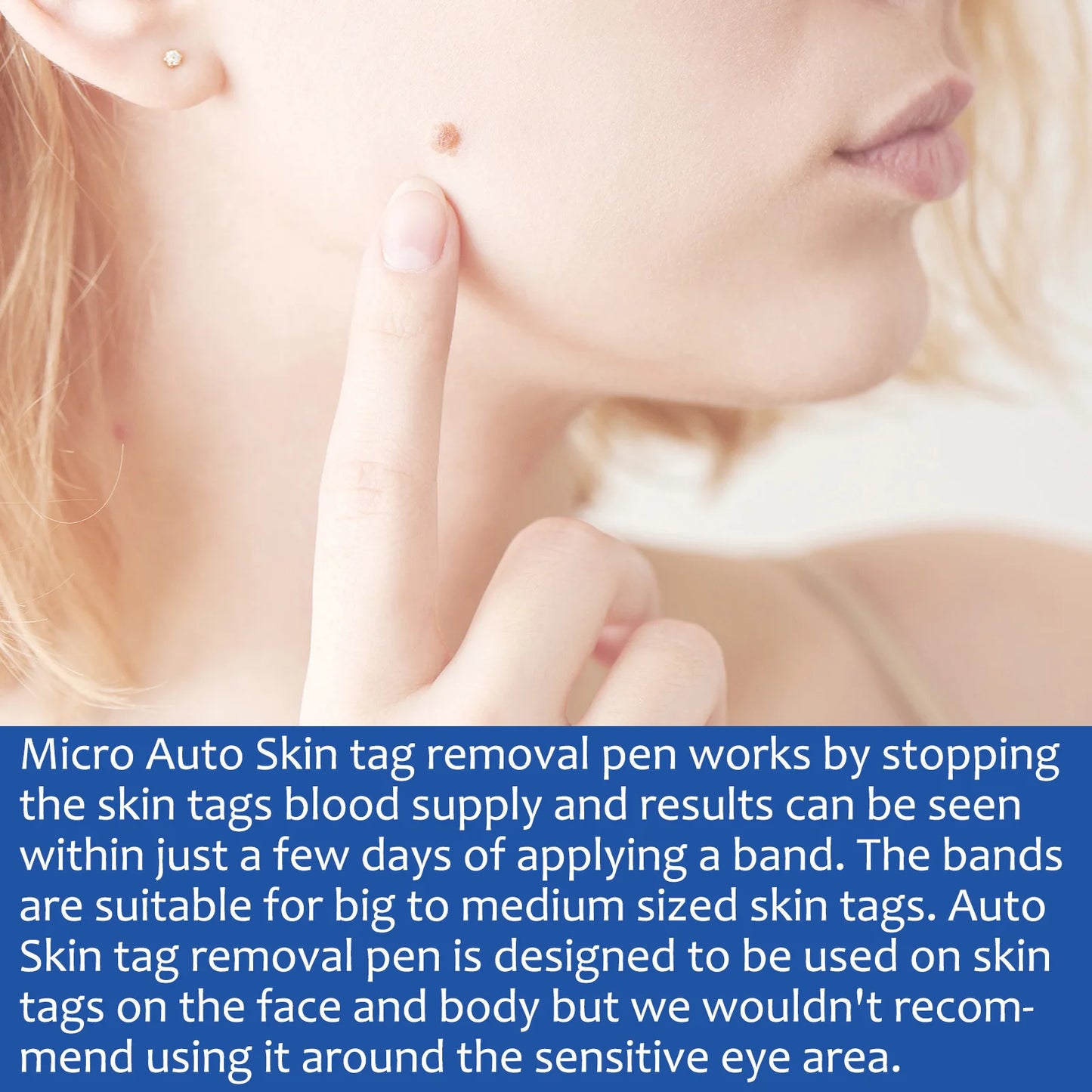 2 In1 Painless Auto Skin Tag Mole Wart Removal Kit Cleaning Tools Face Skin Care Body Wart Dot Treatments Remover Beauty Health