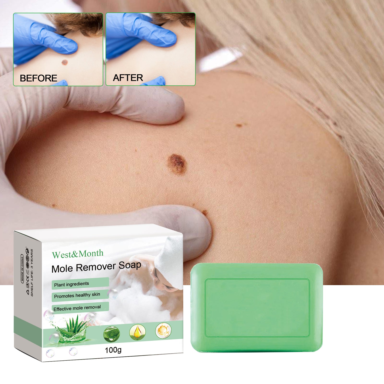 West&Month Mole Remover Soap, Repair Meat Granules Corns And Dark Moles, Smooth Skin Anti-wart Cleansing Soap - LaTezza Online Shop