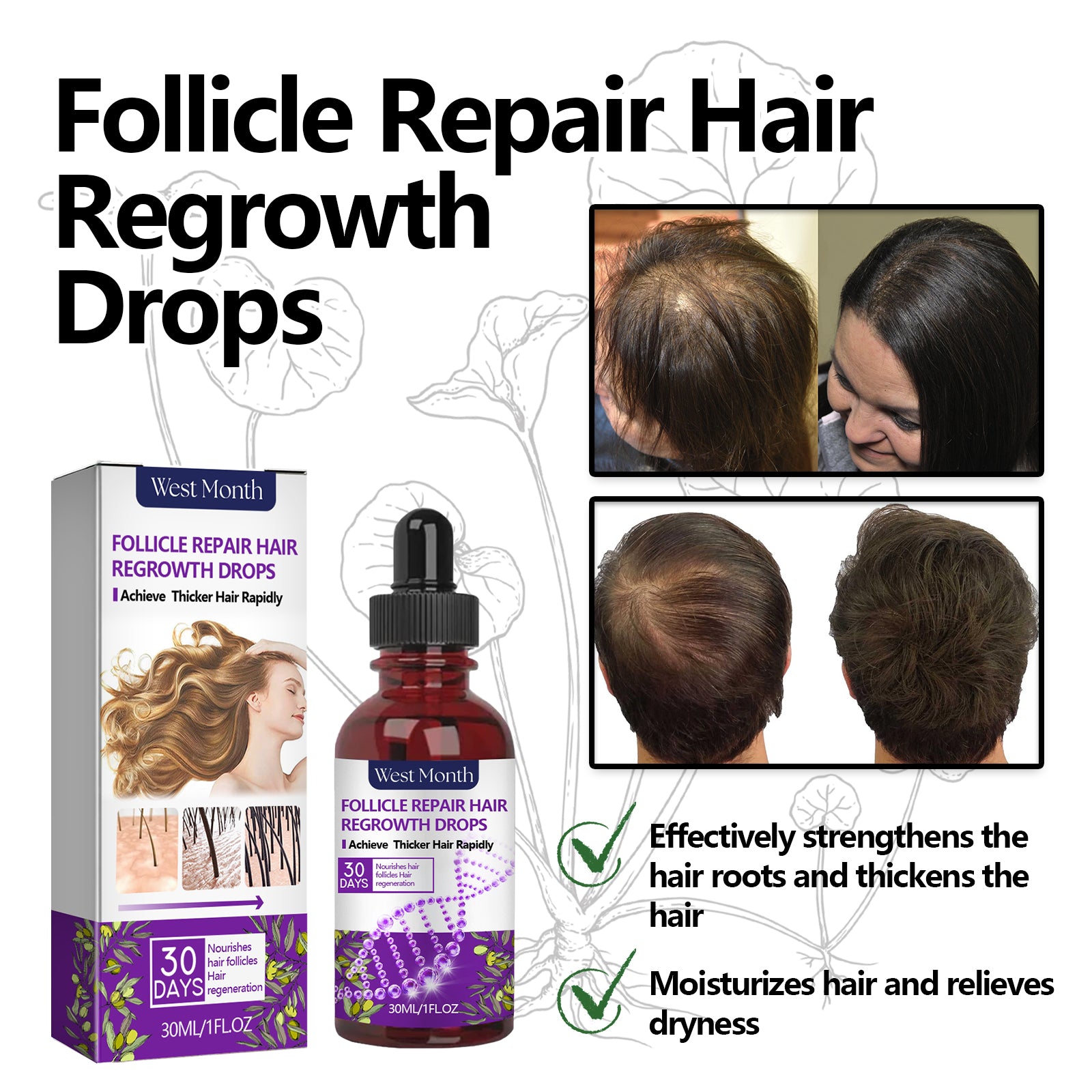 Follicle Repair Hair Regrowth Drops, Hair Protection Strong And Solid Hair Thickening Scalp Nourishing Massage Lotion - LaTezza Online Shop